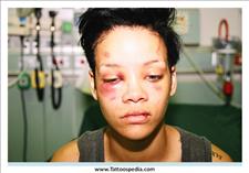 Rihanna Beat Up