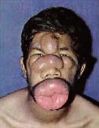 Lip Face