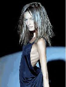 Anorexic Girl